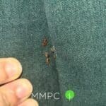 bed bugs in furniture seam