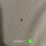bloodstain on sheets