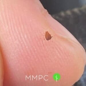 Aphid on finger